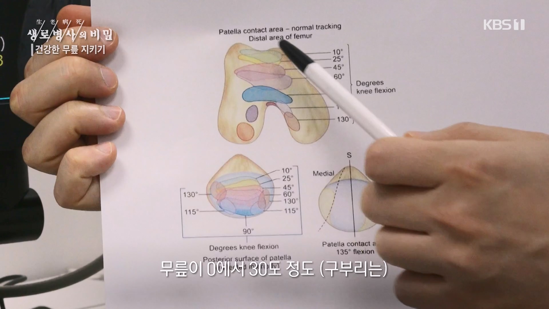 생로병사의 비밀.E873.230607p-NEXT.mp4_20230608_202206.394.jpg