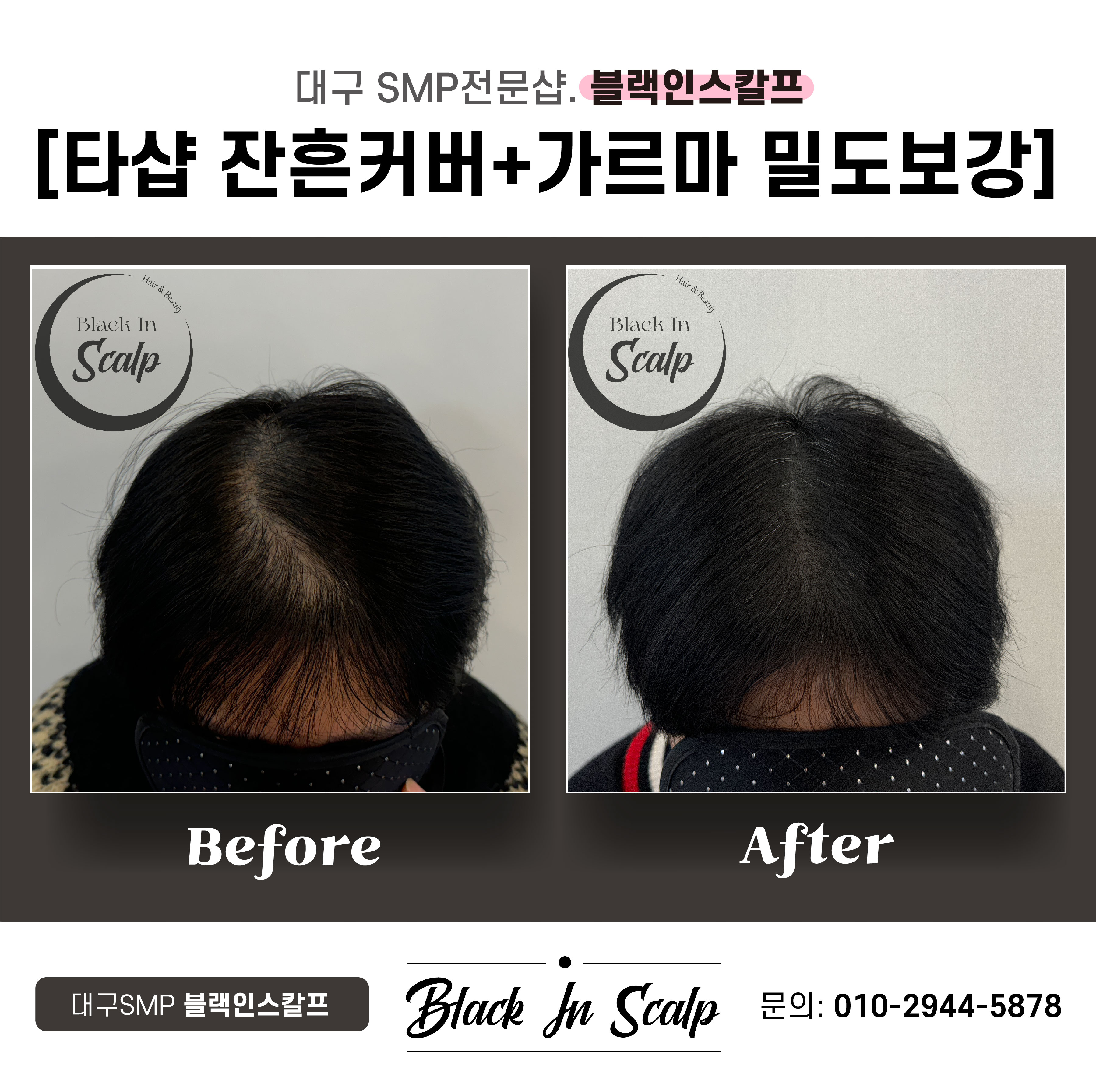 블랙인스칼프 이미지