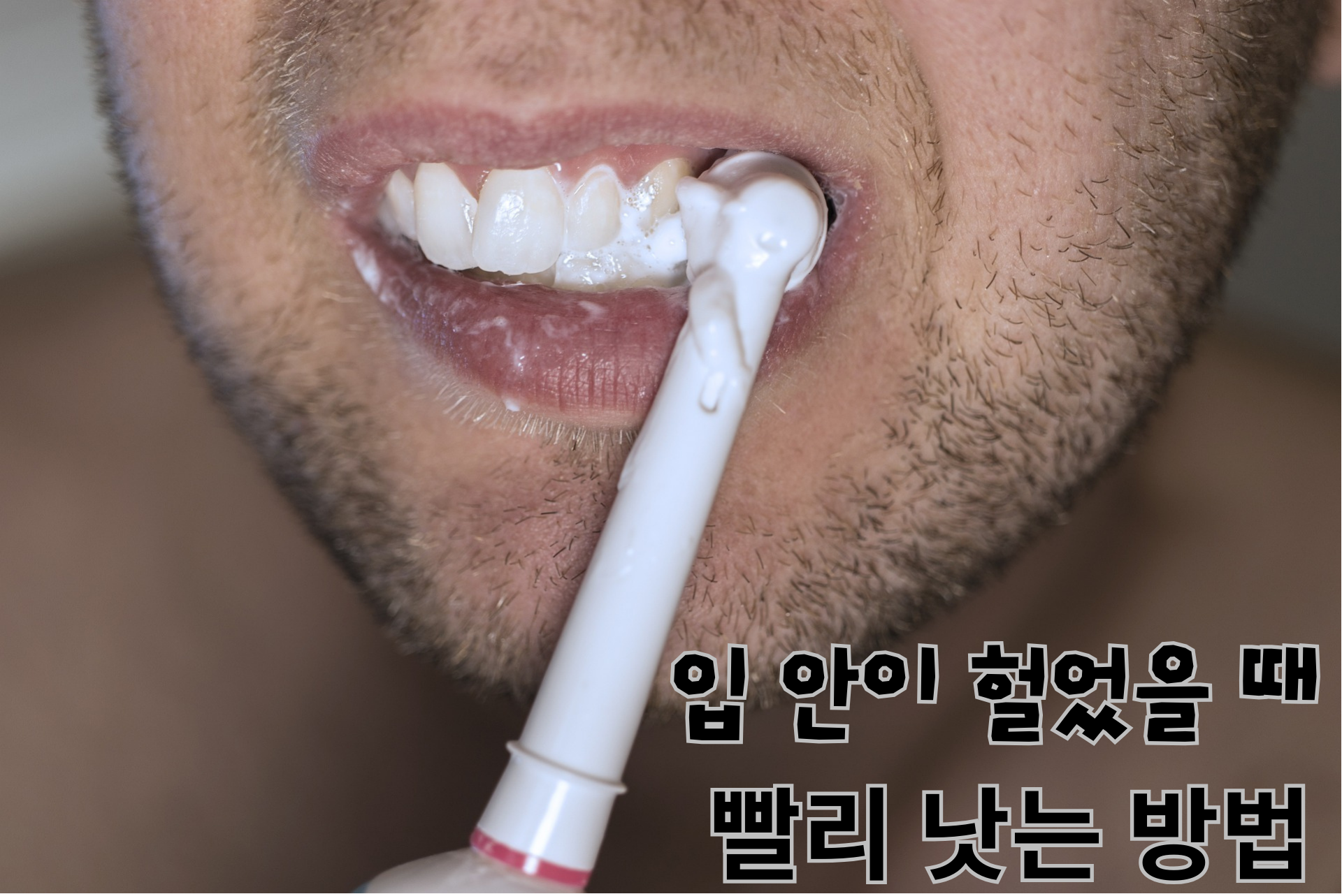  [건강]입 안이 헐었을 때 빨리 낫는 방법 7가지