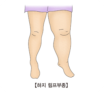 붓기빼는법4