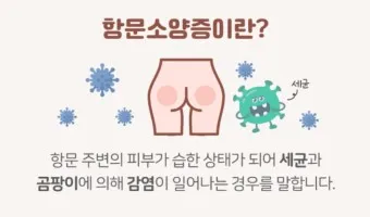 항문가려움 원인 치료방법 관리방법_2