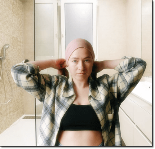 암 치료중인 여성