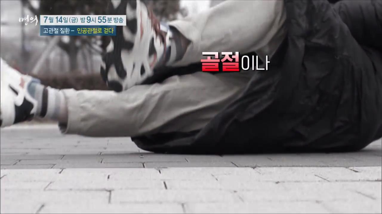 EBS 826회 명의 고관절 질환 - 인공관절로 걷다, 수술 후 합병증, 부작용 및 생활 관리, 퇴행성 관절염, 골절, 대퇴골두무혈성 괴사 치료 방법 강북 삼성병원 박윤수 박재형 교수