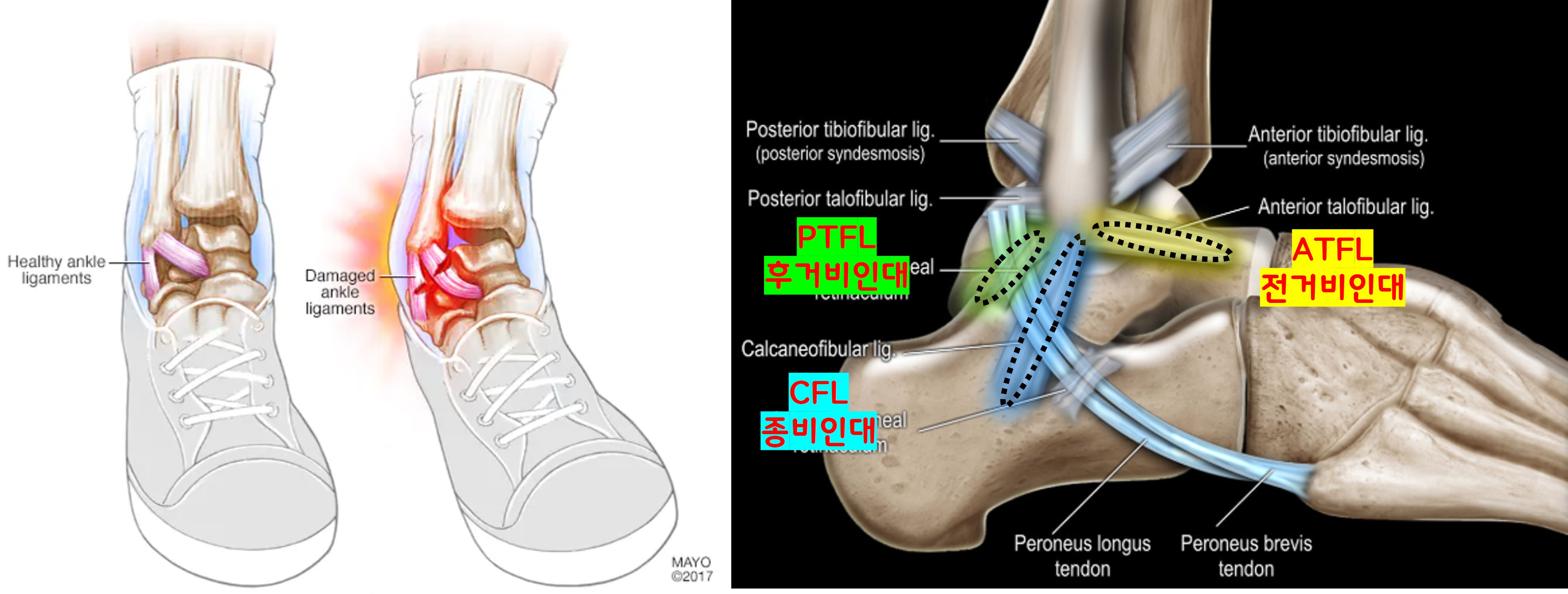 발목 인대의 구조
