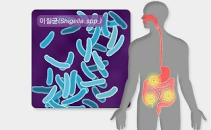 장염 빨리 낫는법