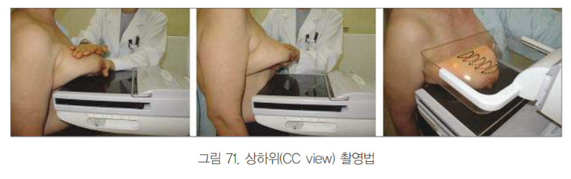  유방암 검진에 대한 모든 정보 모음