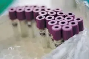 콜레스테롤