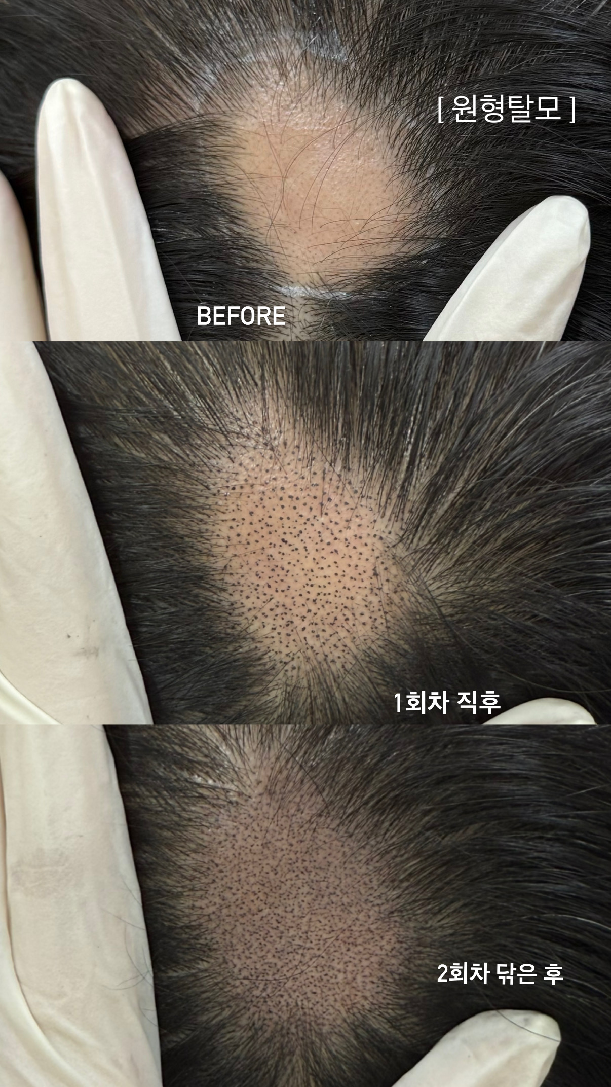 부띠끄서 이미지