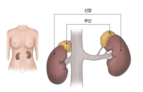  부신암 증상/원인/치료법/생존율