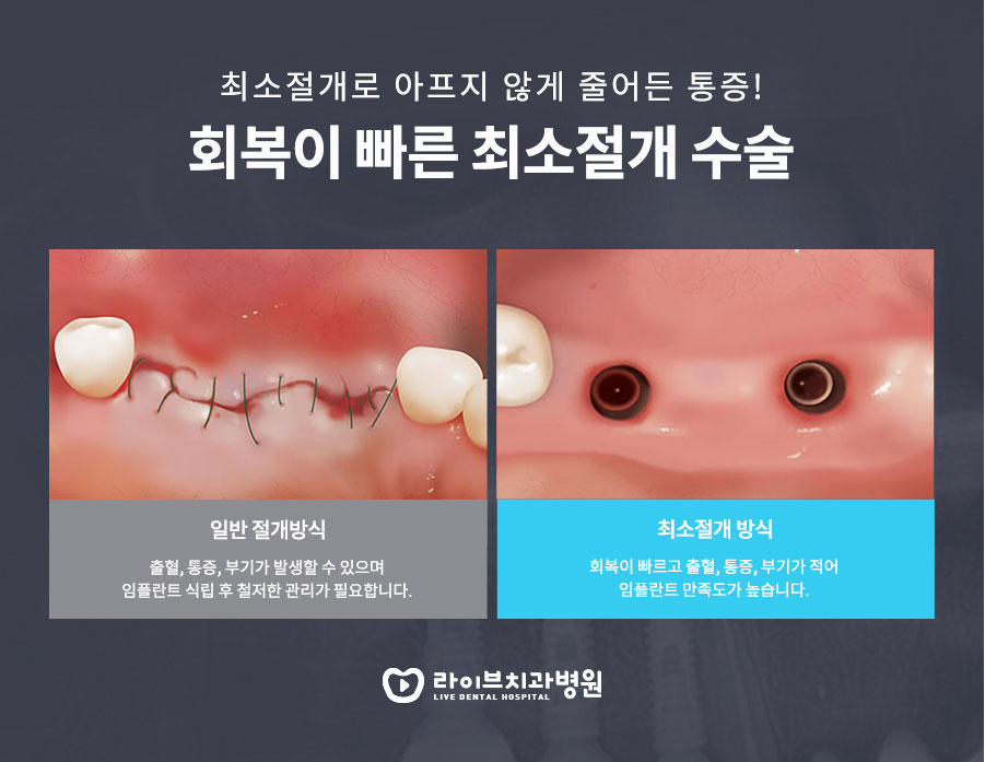강남역임플란트