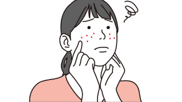 여드름 흉터