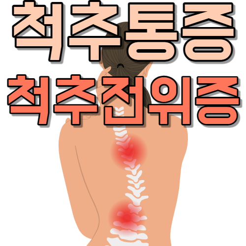 허리-통증-척추-전위증
척추-전위증-원인
척추-병원-추천