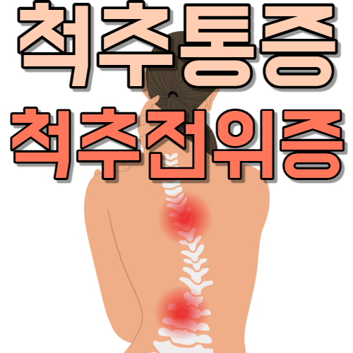  자세를 바꿀 때마다 통증 고통 척추 병원 방문 추천 척추 전위증