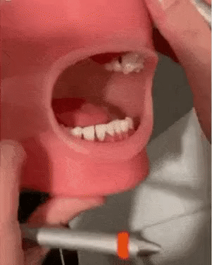  치과에서 의사가 원하는 입 벌리기.gif