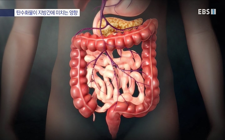 명의_ 제 764회 〈지방간의 경고 1부, 살찐 간이 위험하다〉_ 220429.avi_20220503_193644.274.jpg