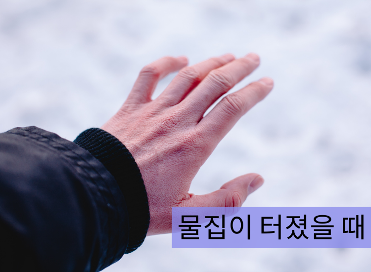 물집 터졌을때