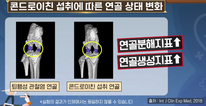 콘드로이친 효능