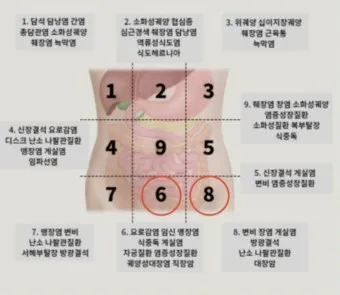 왼쪽 아랫배 통증 움질일때 콕콕 땡김_3
