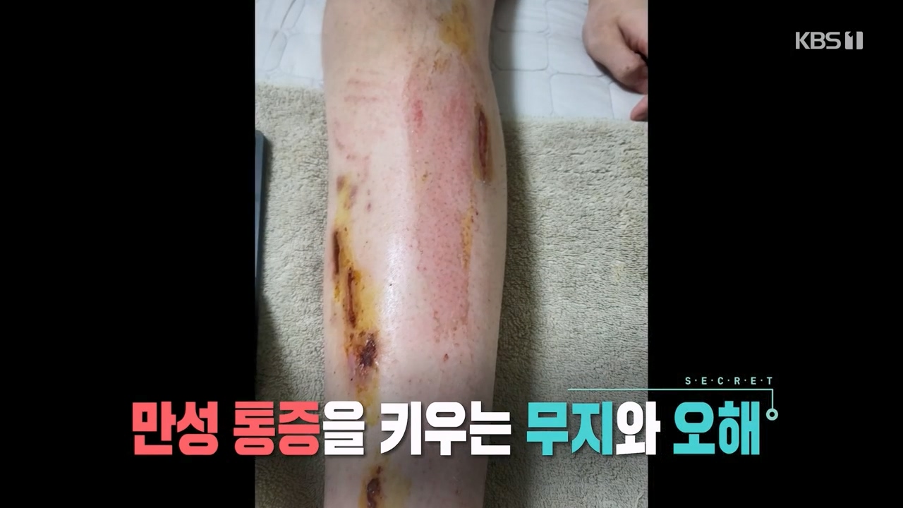 생로병사의 비밀.E897.240125p-NEXT.mp4_20240125_200238.253.jpg