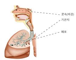 폐에 물이 차는 원인