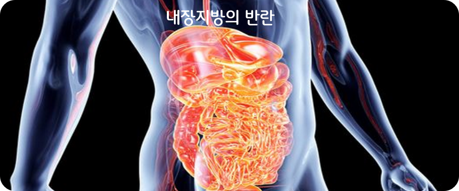 내장지방의 반란 (이미지 출처: mutluvesaglikli.com)