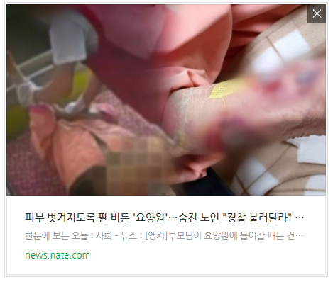  피부 벗겨지도록 팔 비튼 '요양원'…숨진 노인 "경찰 불러달라" 호소