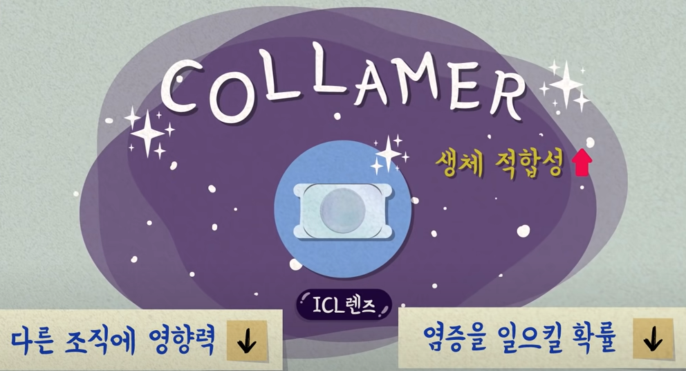 ICL랜즈