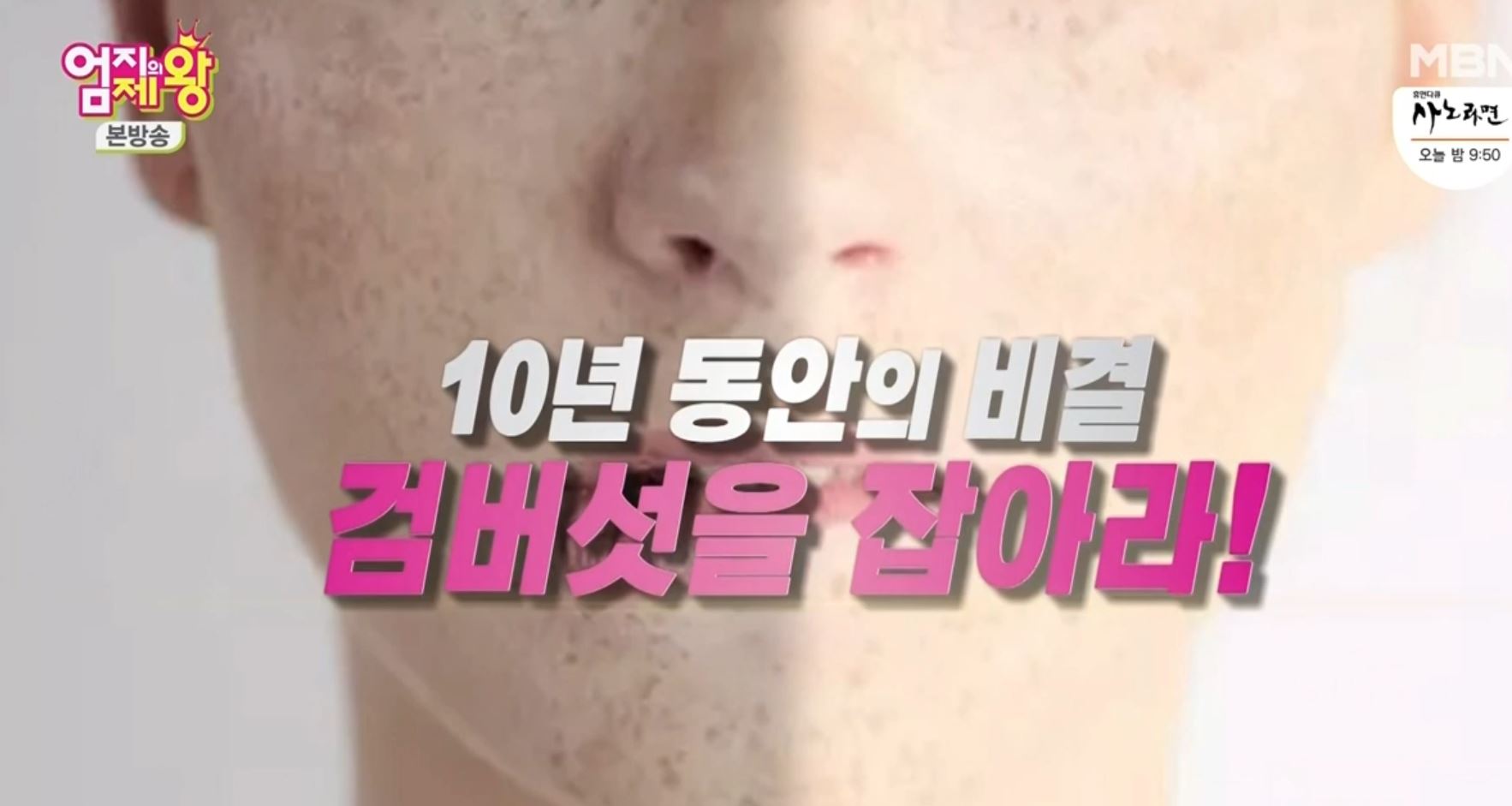  엄지의제왕 검버섯 잡는 항산화 회복수 레시피
