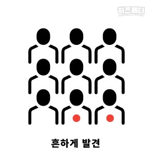 과민성 대장 증후군 증상 원인