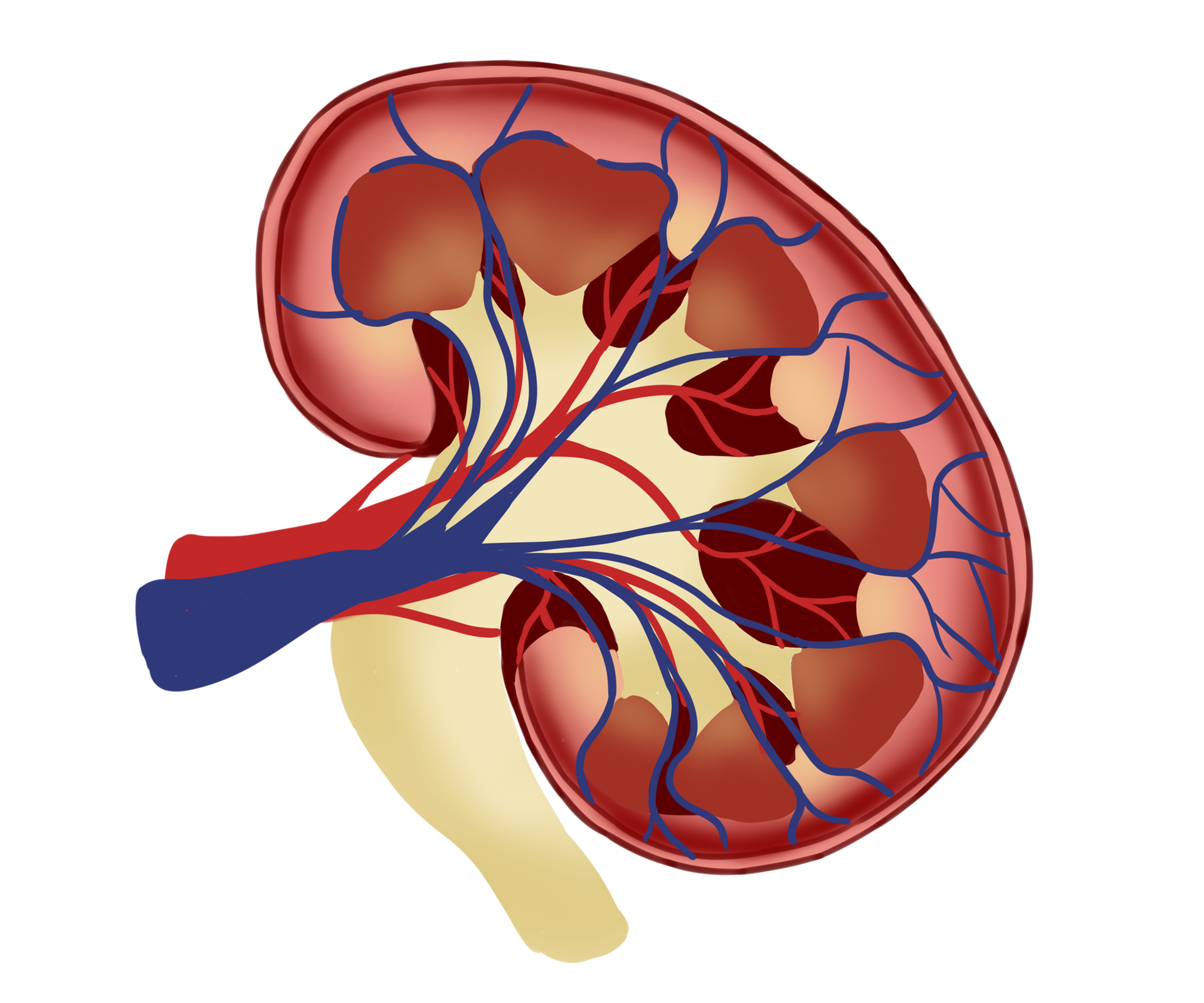 chronic-renal-failure-crf