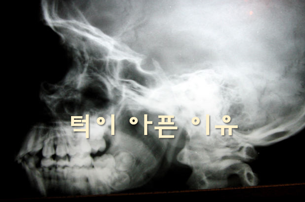  턱이 아픈 이유와 아플 때 가는 병원