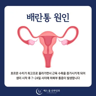 배란통 증상 및 시기 원인_3