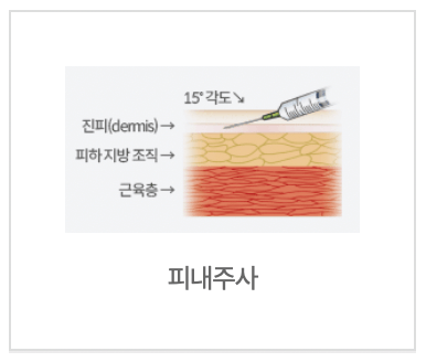 예방접종