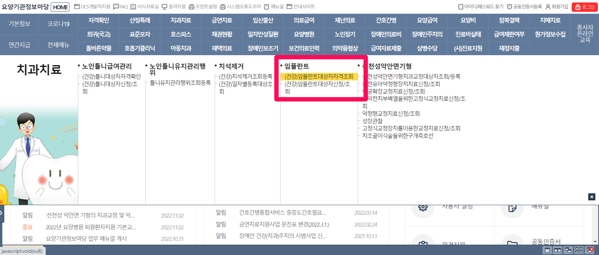 임플란트가격