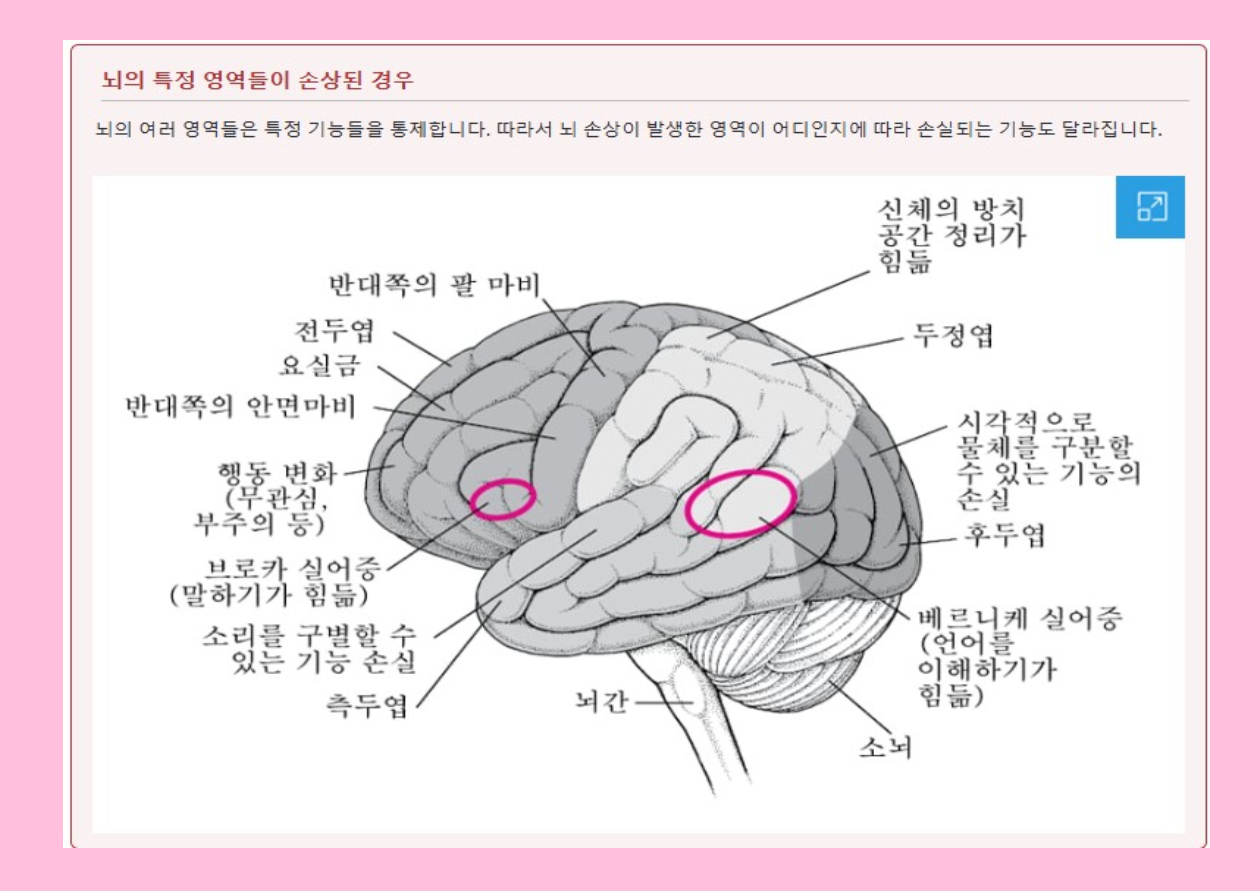 실어증 원인-진단과 치료 서비스