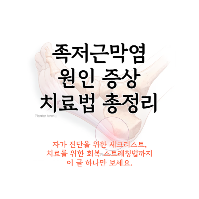 족저근막염-치료법