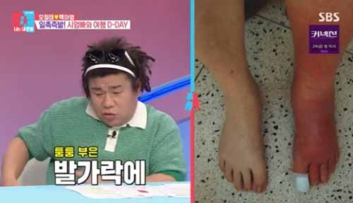 봉와직염 원인 증상 치료