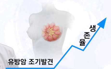 유방암 조기발견과 생존율