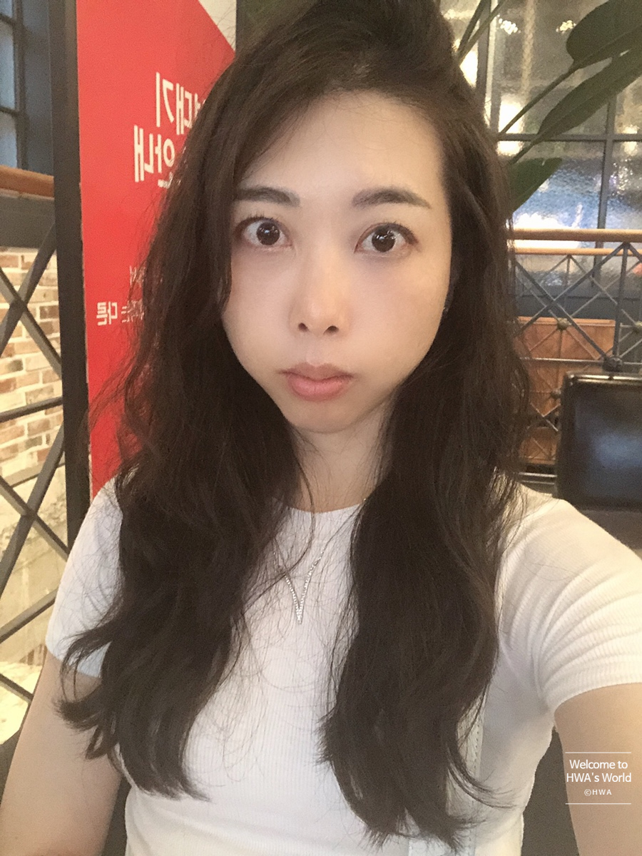 콧볼 축소 비용 [강남/보톡스] 콧볼축소주사-후기 2