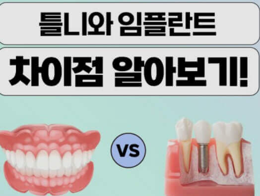  틀니와 임플란트의 가격, 종류, 장단점, 관리 방법 비교하기