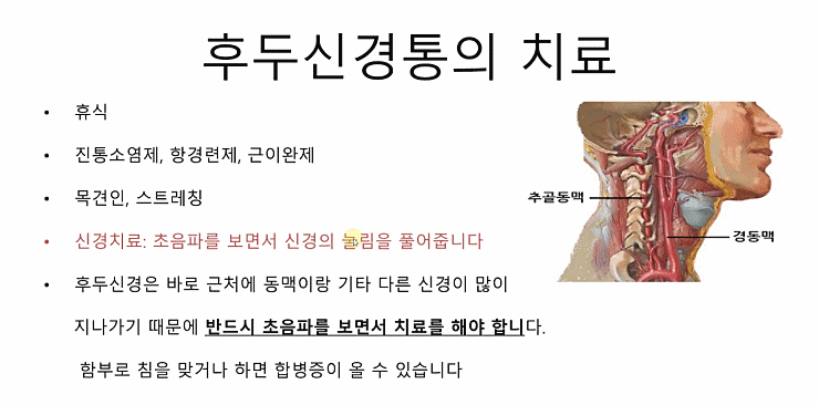 뒷골 땡길때 후두 신경통 의심해 보자 뒷골 땡길때 후두 신경통 의심해 보자