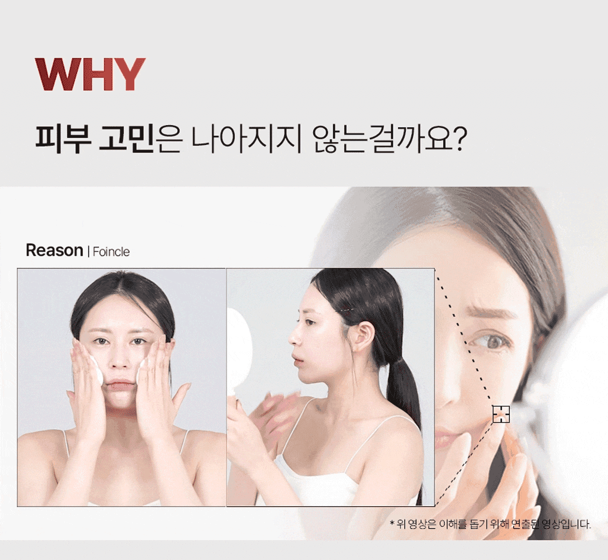 why-skin1