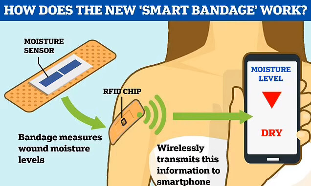  의사가 원격으로 상태를 관리하는 스마트 밴드 'New 'smart bandages' that tell doctors when a wound has healed...