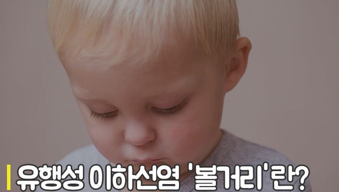  유행성이하선염(볼거리)