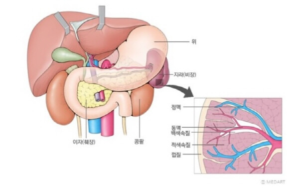 비장-췌장