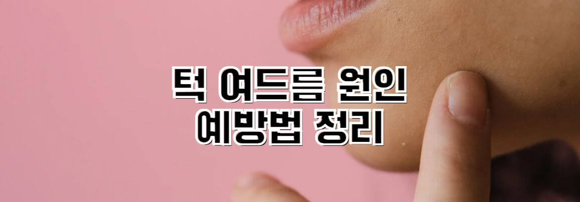 턱-여드름-원인-예방법-썸네일