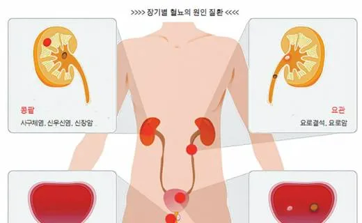 경우 이미지