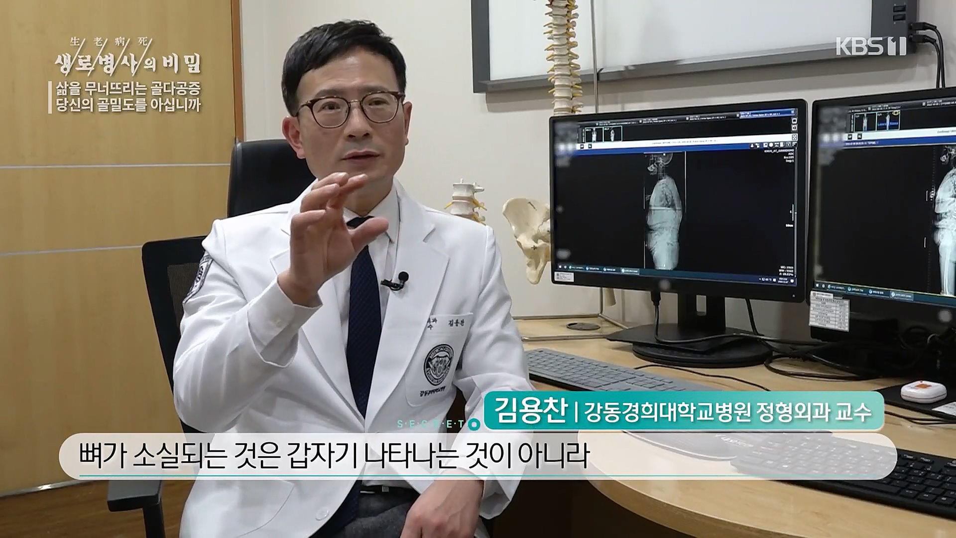 생로병사의 비밀.E852.230118p.H264-F1RST.mp4_20230120_194439.417.jpg