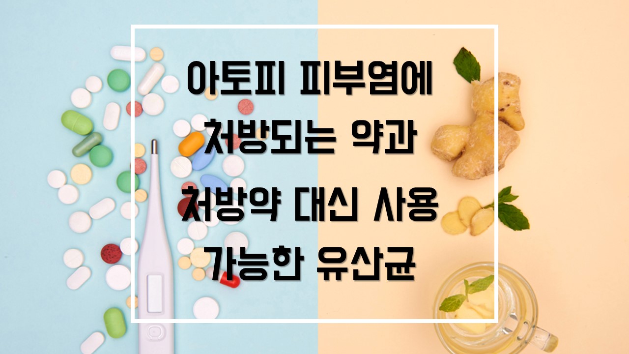  아토피 피부염에 처방되는 약과 처방약 대신 사용 가능한 유산균