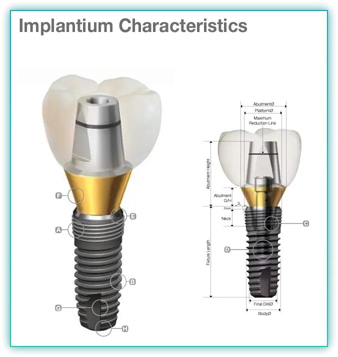 Implantium